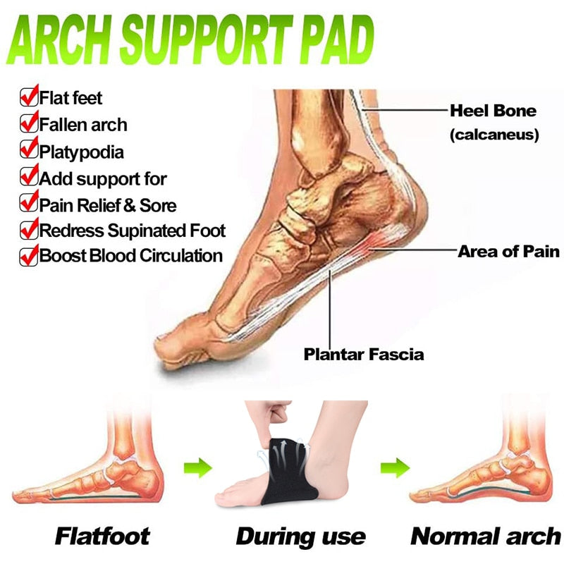 Arch Pad Support