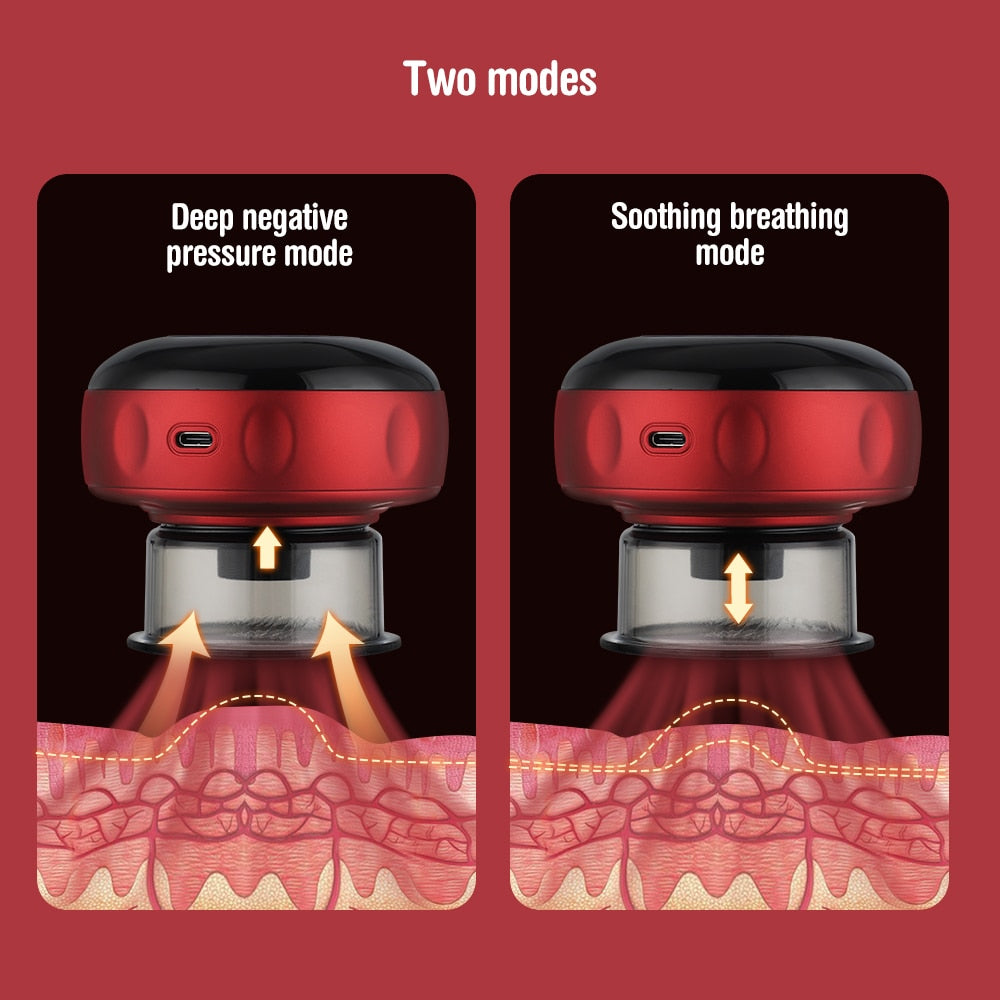 Electric Vacuum Cupping Massage